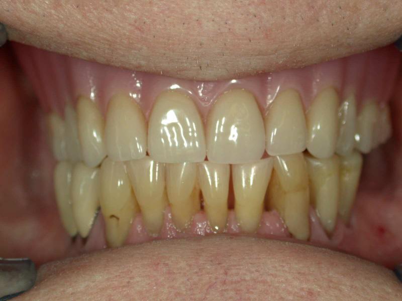 Our Work Turner Dental Laboratory, Victoria BC